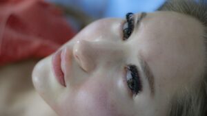 Home Remedies for Acne Scars - Natural solutions for smoother skin.