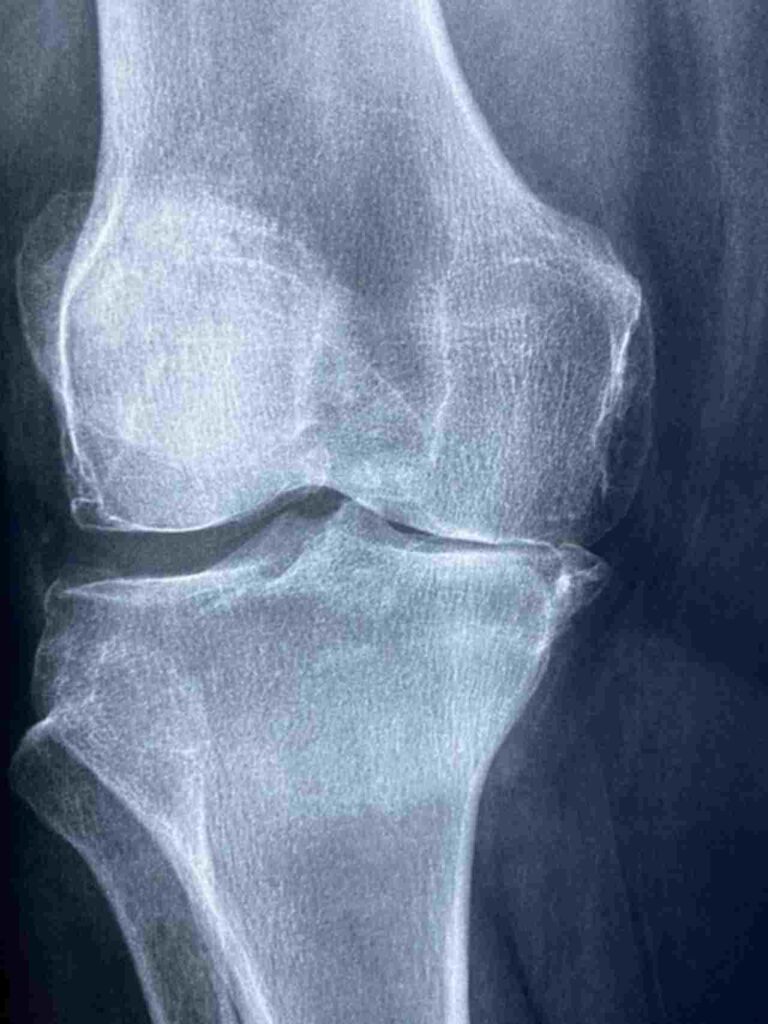 Silhouette of a person holding their painful joint.