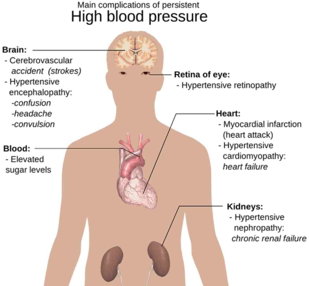 "Collage of 12 nutritious foods for managing hypertension, promoting heart health."
