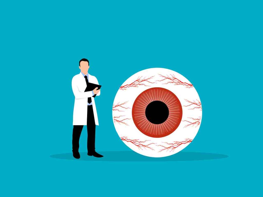 Illustration of an eye with an eye infection.