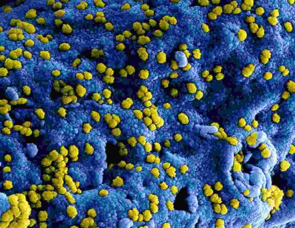 "Image depicting a researcher in a lab, symbolizing the fight against superbugs and antibiotic resistance."