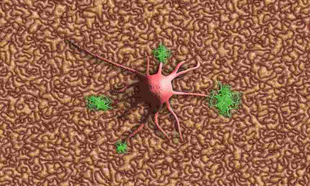 Illustration of neurons connecting, representing the complexity of the nervous system.