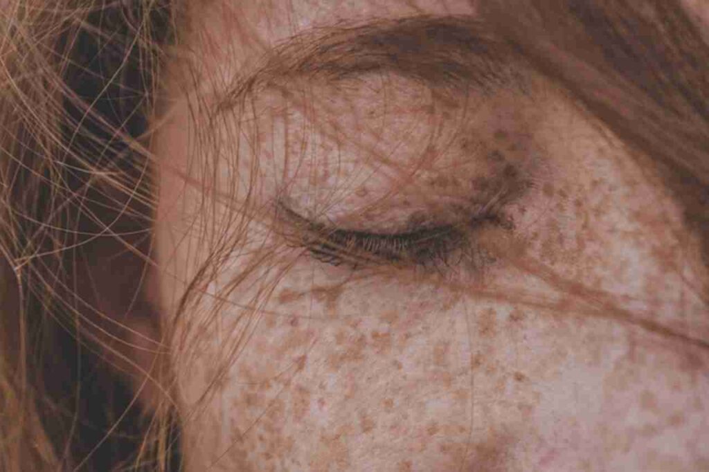 "Image of freckles on a sun-kissed face."